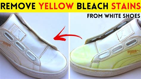 how to clean white shoes that turned yellow|white shoes yellow stain remover.